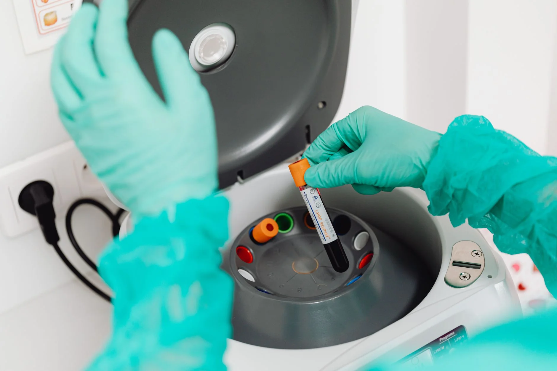 Alzheimer Kan Testine FDA İzni: Kimlere Yapılıyor, Neyi Söylüyor?